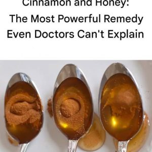 Cinnamon and Honey: The Most Powerful Remedy Even Doctors Can’t Explain