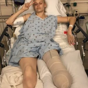 Her legs are amputated after using a common household product
