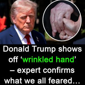 Trump Displays Wrinkled Hands, Sparking Fresh Health Concerns