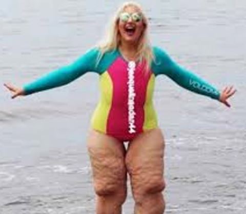 Woman has smart response to bullies mocking “disgusting” legs
