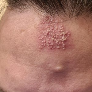 These are the consequences of sleeping with…See more