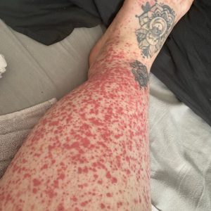 These are the consequences of sleeping with…See more