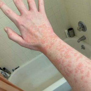 These are the consequences of sleeping…See more